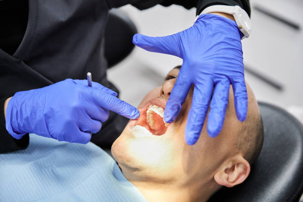 Best Broken Tooth Emergency  in Vance, AL